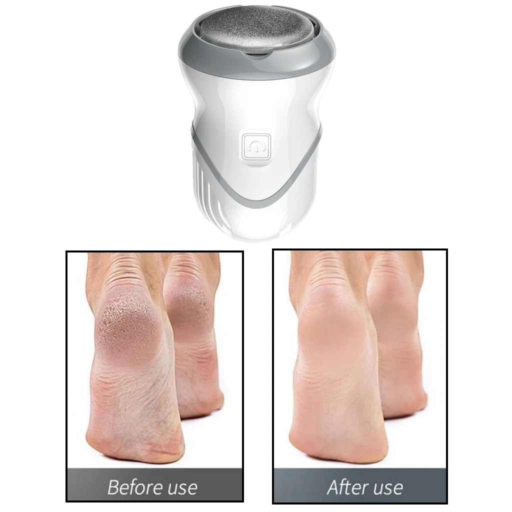 Foot Hard Skin Remover Electric Callus Remover Foot Files Pedicure Rechargeable Foot Grinder Vacuum Callus Remover Machine