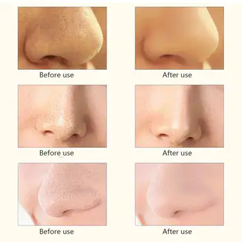 

Electric Blackhead Remover Vacuum Dot Nose Pore Face Suction Skin Beauty Deep Cleansing Acne Machine Care Tools Clea R9N1