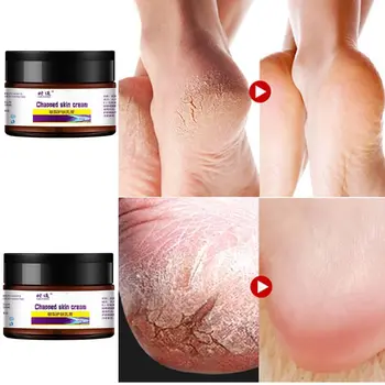 

30g Hand Foot Chapped Skin Cream Herbal Heel Anti-Drying Crack Nourish Ointment T4MB