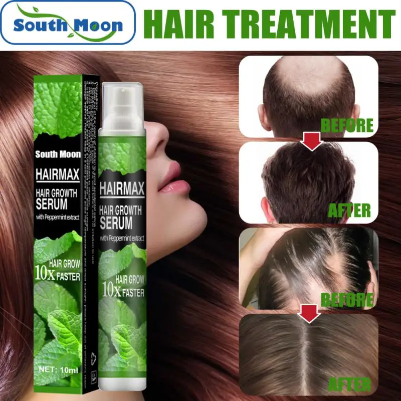 South Moon Hair Growth Spray Serum Anti Hair Loss Products Fast Grow  Prevent Hair Dry Frizzy Damaged Thinning Repair Care - AliExpress
