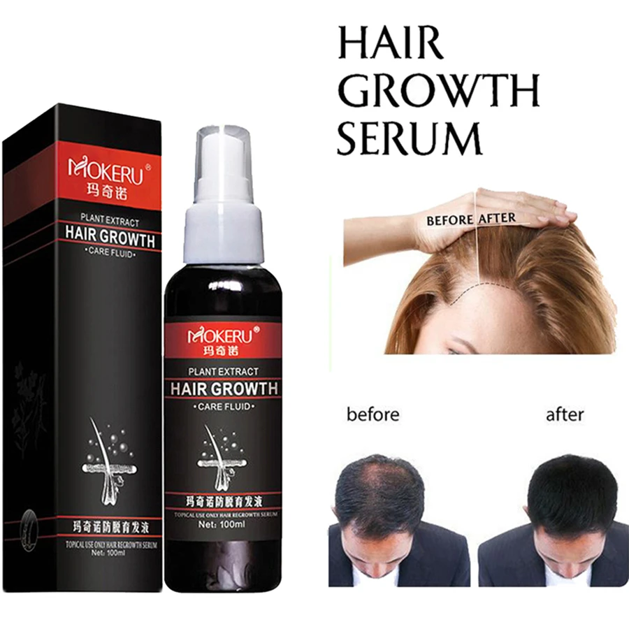 Mokeru 100ml Essenza Di Zenzero Biologica Prodotti Per La Perdita Dei Capelli Olio Spray Per La Crescita Dei Capelli Selvatici Per Uomo Donna Trattamento Calvizie Hair Loss Products Aliexpress Mokeru 100ml Essenza Di Zenzero Biologica Prodotti Per La Perdita Dei Capelli Olio Spray Per La Crescita Dei Capelli Selvatici Per Uomo Donna Trattamento Calvizie Hair Loss Products Aliexpress