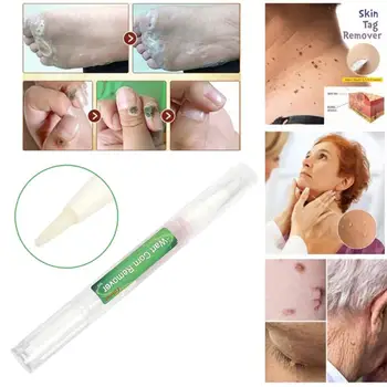 

3ml Skin Tag Remover Pen Tu Kill Remover Medical Skin Tag Mole Genital Wart Remover Foot Corn Verruca Wart Remover Liquid NEW