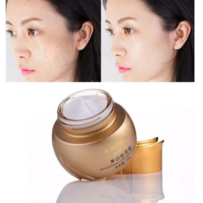 30g Whitening Freckle Cream Natural Formula Brightening Acne Spot Remover Treatment Facial Essence Lotion Skin Care Cosmetic
