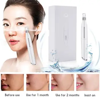 

White Electric Micro Needle Pen Auto Derma Pen Effective Auto MicroNeedle Pen Beauty Fashion Pimple Remover