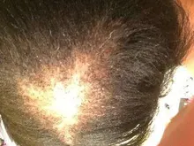 Cuidado del cabello para el crecimiento del cabello aceites esenciales esencia Original auténtico 100% pérdida de cabello líquido salud belleza suero denso para el crecimiento del cabello