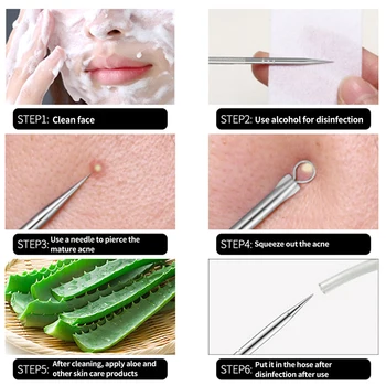 4PCS Acne Blackhead Comedone Black Spot Pimple Blemish Remover Skin Care Women Beauty Acne Treatment Pore Cleanser Needle Hook 6