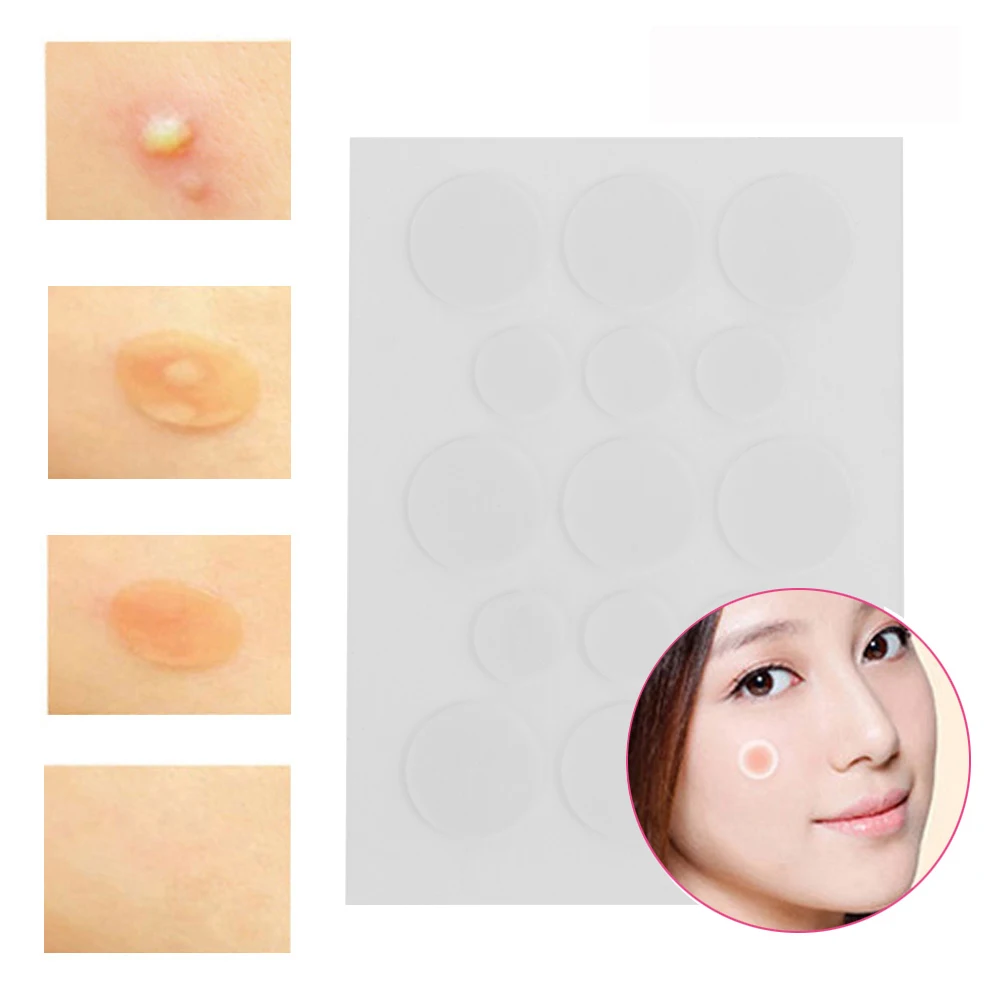 

NEW 15 Pcs/Sheet Skin Tag & Acne Patch Hydrocolloid Acne and Skin Tag Remover Patches Pimple Spot Treatment Acne Stickers