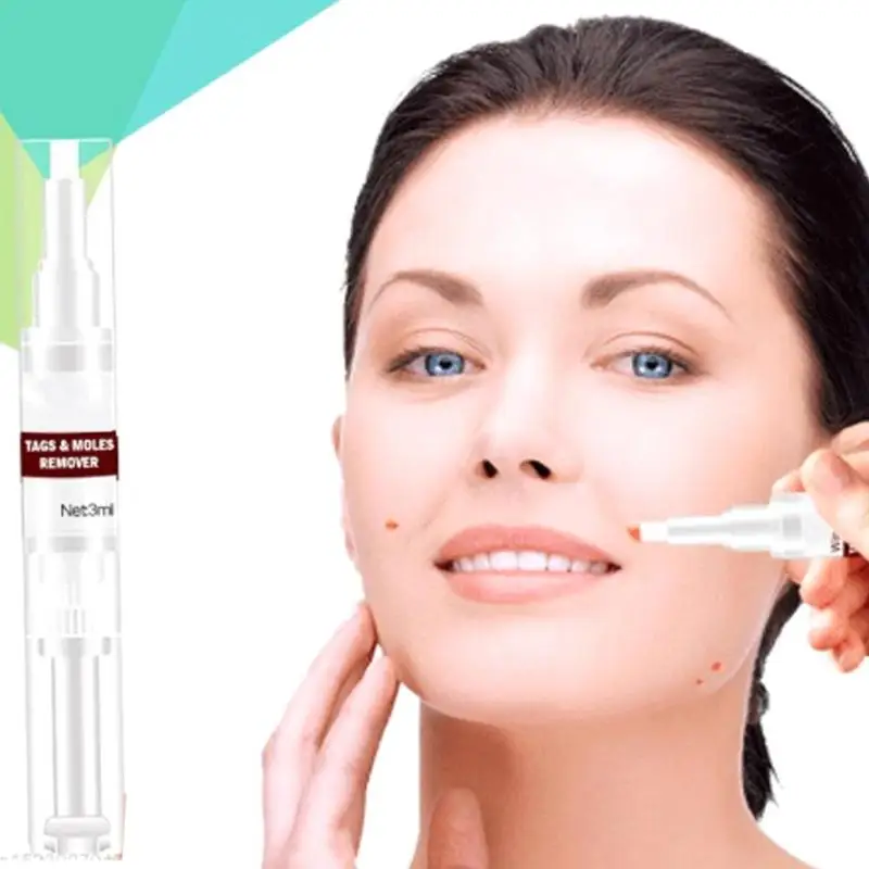 

3ml Remover Liquid Wart Removal Pen Genital Wart Treatment