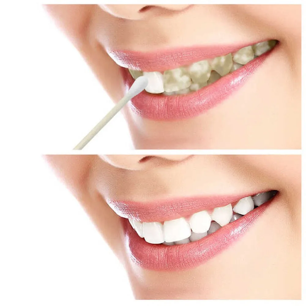 Зубная пудра зубная паста для отбеливания уход удаление Halitosis зубной налет стоматологический чистящий порошок Отбеливание зубов порошок 50 г