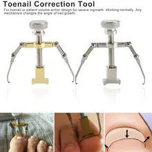 Инструмент для ухода за ногтями ортопедический корректор для педикюра инструмент 1 шт. полезный инструмент для коррекции вросших ногтей Педикюр закрепитель для ногтей на ногах
