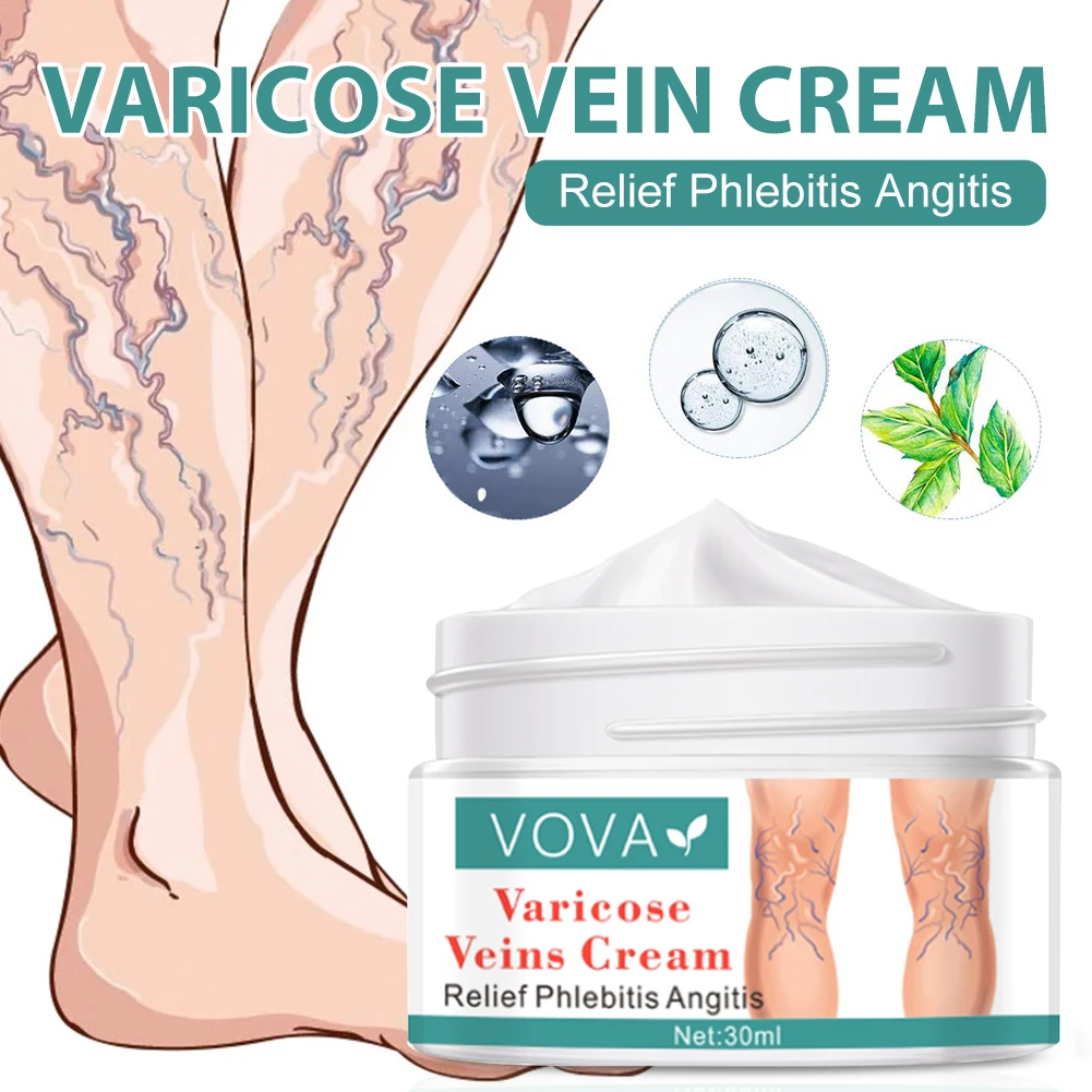 Varicose Veins Cream Relieves Phlebitis Angiitis Inflammation Blood