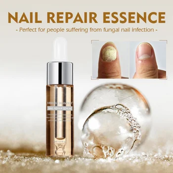 

15ml Effective Toe Nail Fungus Treatment Nail Repair Solution Anti Fungus Onychomycosis & Paronychia Nail Care Nail Treatment