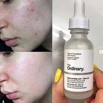 

The Ordinary Niacinamide 10% + Zinc 1% Essence Pore Treatment Serum Liquid Oil Control Moisturizing Skin Care Make up Base 30ml