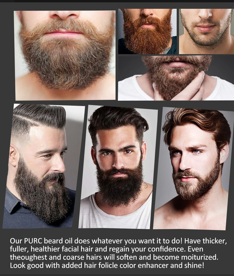 Этапы отрастания бороды. Правильный рост бороды. Выпадение волос у мужчин до после. Легкая щетина. Густая борода фото.