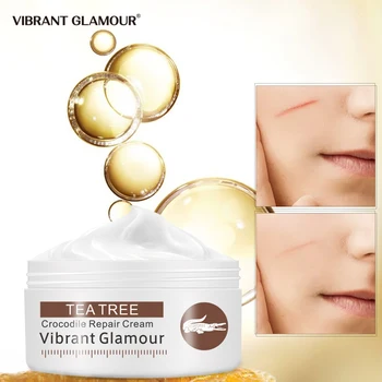 

VIBRANT GLAMOUR Crocodile Dispel Scar Repair Face Cream Remove Acne Scar Stretch Marks Treatment Lightening Whitening Skin Care