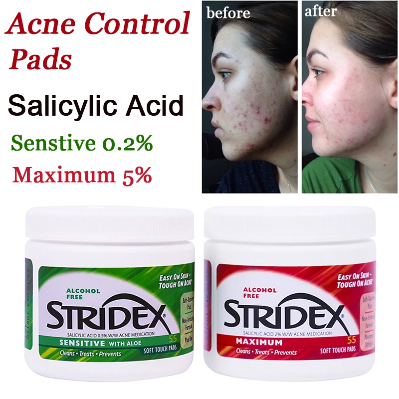 pedir patinar Jarra Tratamiento del acné Stridex, almohadillas de Control del acné con ácido  salicílico 0.5% 2% mujeres hombres eliminar espinillas manchas almohadilla  clara 55 Uds|Tratamientos y mascarillas| - AliExpress
