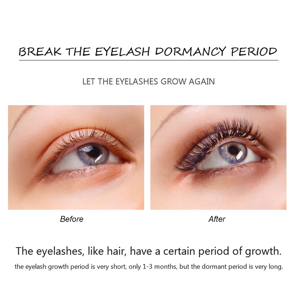 FEG Eyelash Growth Serum100% Original Eyelash Treatment Serum Natural Medicine Eyelash Growth Enhancer Lengthening Longer makeup