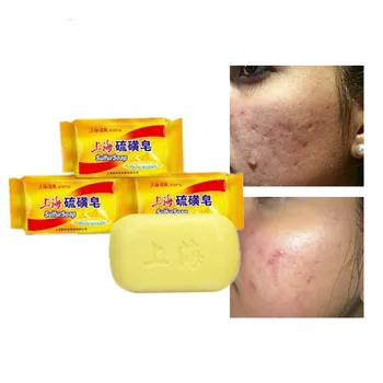 

Shanghai Sulphur Bath Soap is on sale Sterilization and acaricide removal Powerful skin cleaning. Prevention of psoriasis fungi