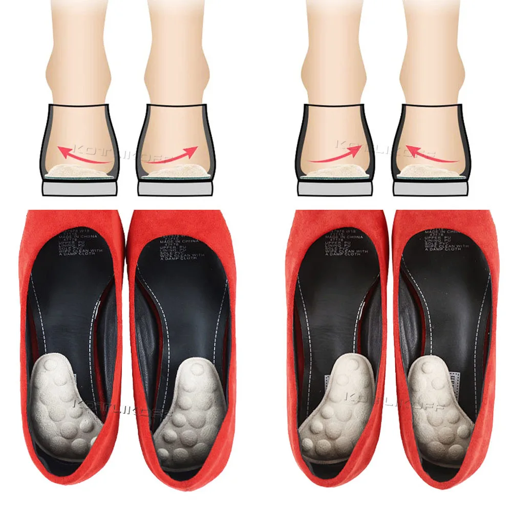 Unisex O/X Leg Valgus Varus Corrector Orthotic Insoles Foot Pads Heel Correction Pads Inside Outside Feet Insert Insoles shoe insoles
