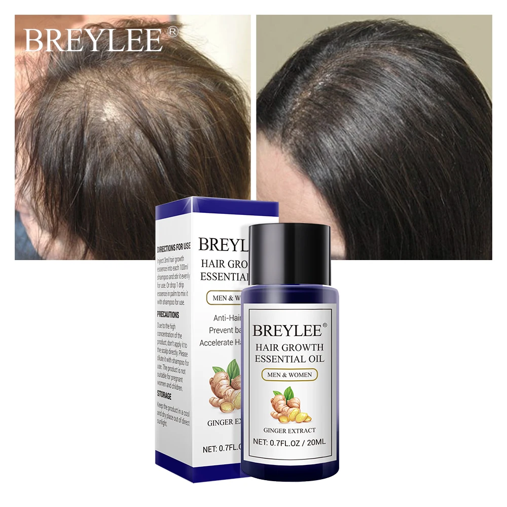 BREYLEE Hair Growth Essential Oil 20ml Fast Powerful Hair Products Hair Care Prevent Baldness Anti-Hair Loss Hair Serum Beauty  (5)