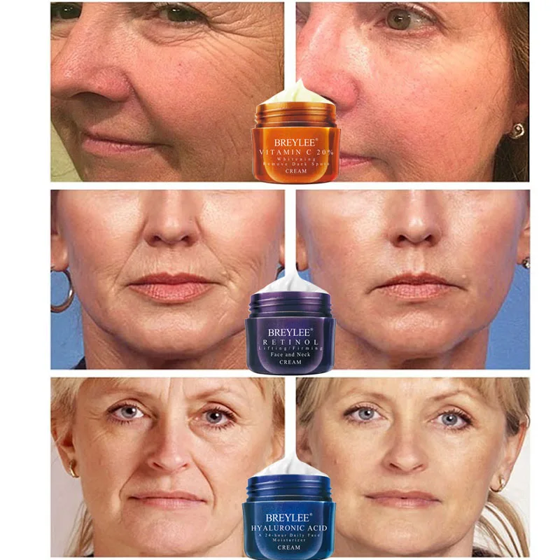 BREYLEE Retinol Firming Face Cream Lifting Neck Anti-Aging Removing Wrinkles Night Day Moisturizer Whitening Skin Care 40g | Красота и