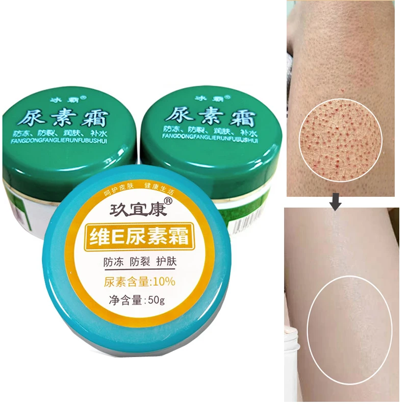 

Urea Cream 10% to Chicken Skin Hand Cream Winter Foot Dry Anti-chapped Repair Cream Vitamin E Body Cream More Types Choose