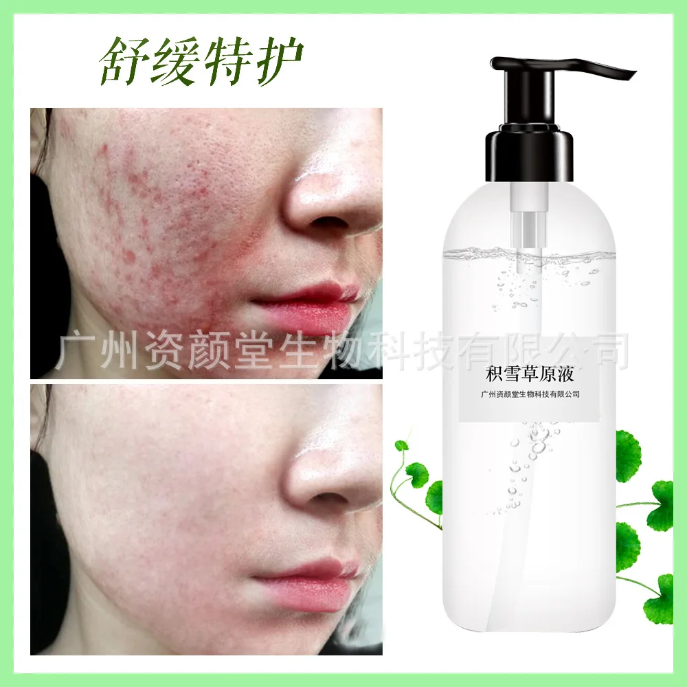 

Centella Asiatica Liquid Essence Repair Sensitive Pulling Narrowed Pores Get Rid of Acne Light Pits