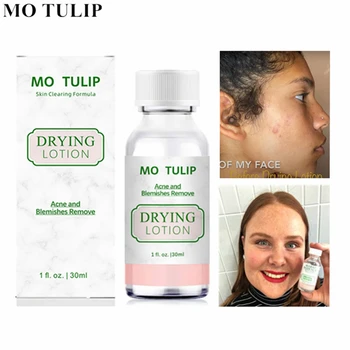 

MO TULIP Effective Acne Treatment Original Mario 30ml Badescu Drying Lotion Anti Acne Serum Pimple Blemish Removal Skin Care