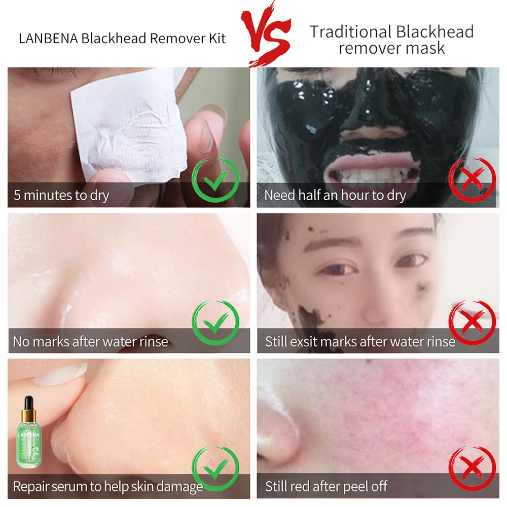 LANBENA средство для удаления угрей сыворотка лица маска уменьшения пор очищающая