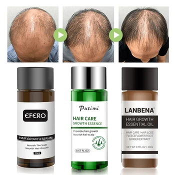

20ml Hair Growth Serum Effective Loss Hair Growth Essence HairCare Hair Growth Essence Damaged Hairs Nutrition For Women And Men