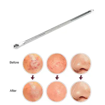 

Portable Stainless Steel Removal Blemish Pimple Acne Blackhead Extractor Treatment Pore Cleaner Needle Face Skin Care Tools