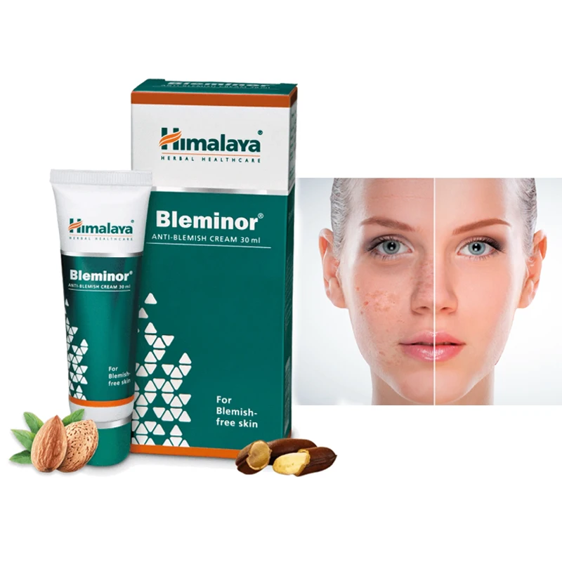 Himalaya Bleminor Anti Blemish Cream 30ml Hyperpigmentation Acne Remove