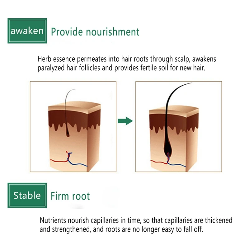 10 мл поврежденные волосы восстанавливающие рост быстрее рост волос сывороточная эссенция анти Предотвращение выпадения волос жидкость