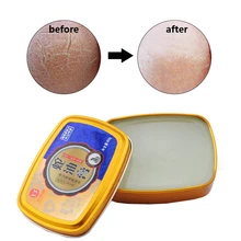 Змеиное масло для нежных рук Крем для рук антибактериальный уход против обветривания отбеливающий питательный антивозрастной крем для ухода за кожей против растрескивания