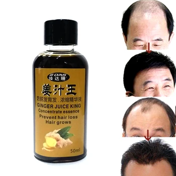

Hair Loss Product hair care Rapid effects postpartum Seborrheic alopecia Restorer medicine densely growth shampoo cream Dandruff