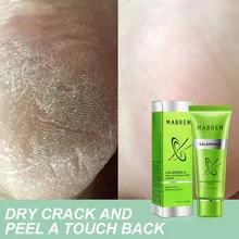 Стойкий увлажняющий крем для ног для сухих каблуков и ног Антибактериальный крем для ног