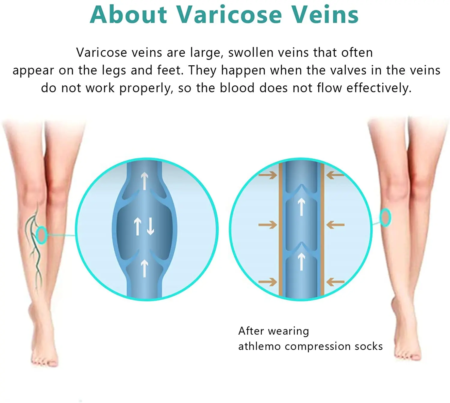 

Compression Pantyhose Women 20-30mmHg Opaque Stocking Medical Quality Graduated Support Hose for Vericose Veins