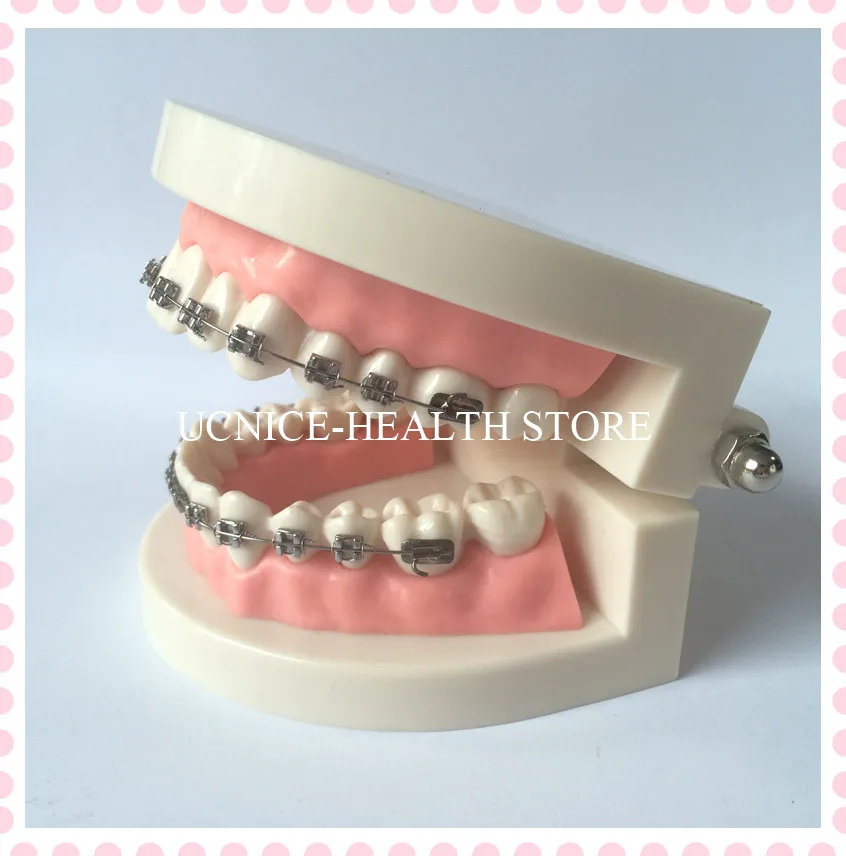 Orthodontic teeth model-3