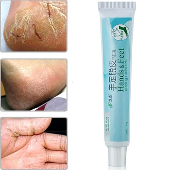 

Foot cream hand cream crack crack heel cream rough chapped heel moisturizing skin care