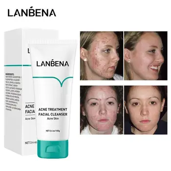 

Lanbena Cleanser For Ance Skin Acne Treatment Soft Cleansing Moisturizing Smooth Whitening Skin Deep Pore Care Shrink Y3I5