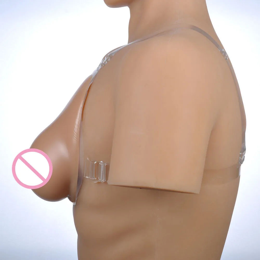 breast prosthesis