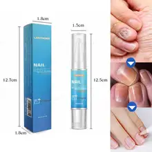 Ручка для лечения грибка пальцев ног onychomicosis Paronychia против грибков, Китайский Травяной Уход за ногтями