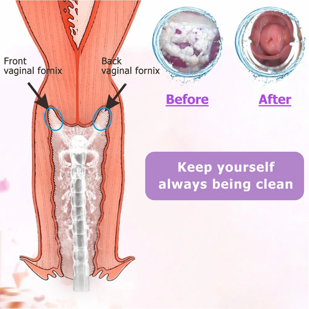 300 мл Анальная вагинальная очитститель клизмы Colonic ирригация вагинальный шприц флушер для женщин личные части Бутылка для очистки