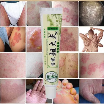 

1pc 15g Skin Antibacterial Cream Eczema Psoriasis Ointment Pruritus Dermatitis Itching Chinese Herbal Medical Plaster New