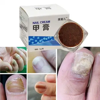 

1pcs Anti-Fungal Cream Nail Treatment Pen Onychomycosis Anti Infection Paronychia Chinese Herbal Care Medicinal Ointment