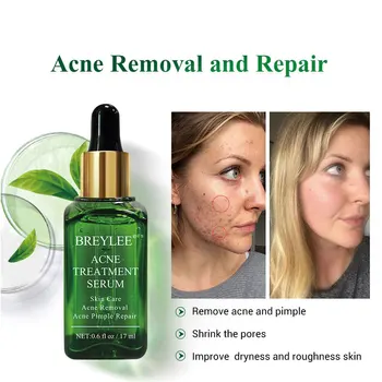 

AcnePimple Patch Acne Treatment Serum Acne Cream Pimple Remover Tool Skin Care Face Cream Facial Serum Essence Face Mask