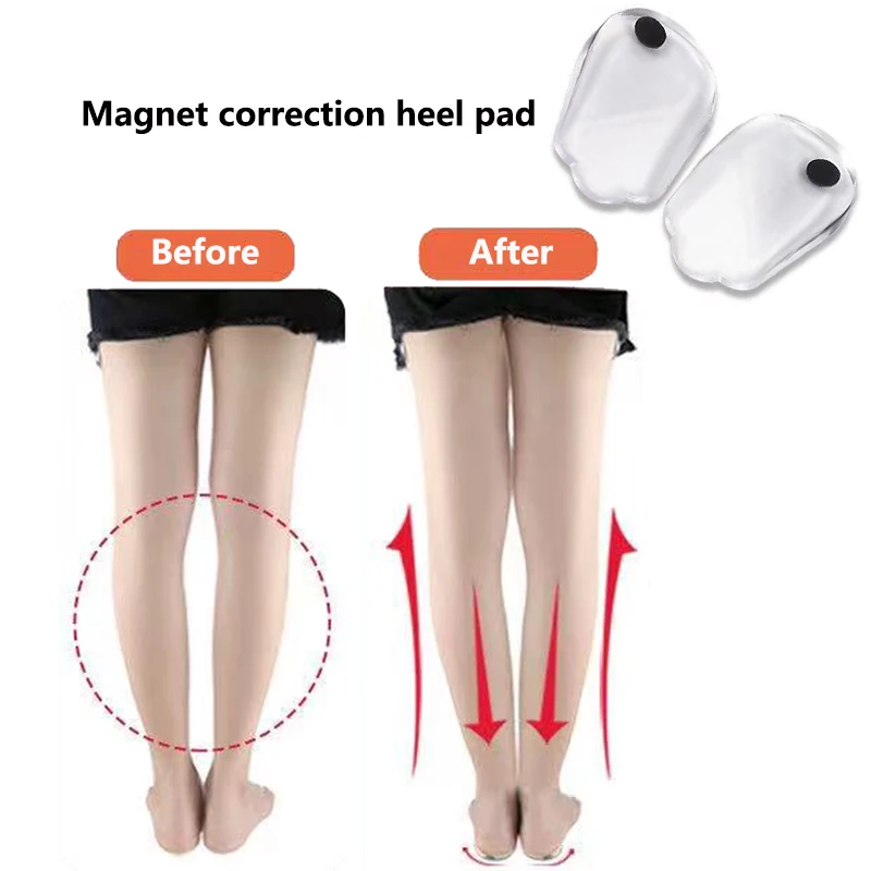 1 Pair Magnet Silicon Orthopedic Insoles Foot Care Tool For Men Women Health Care O/X Type Leg Knee Varus Correction Heel Pad