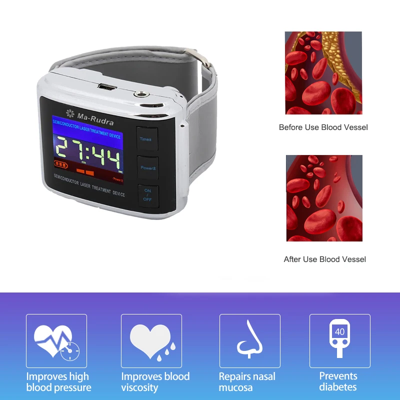 High Blood Pressure Diabetic Watch Multifunction Wrist Watch Pain Relief Rhinitis Diabetics Hypertension Laser Therapy Device