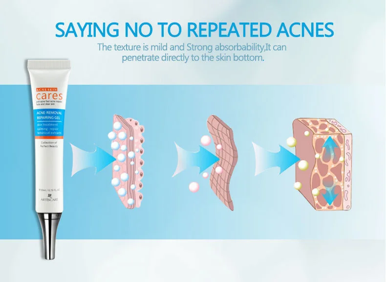 anti-acne_07