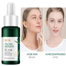 Tea Tree Essence 17ml Facial Moisturizing Skin Care Products Whitening Anti-aging Wrinkle Facial Skin Care Products Skincare